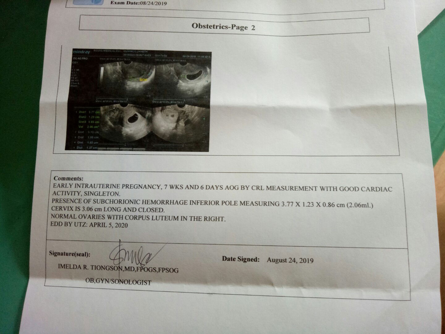 Subchorionic Hemorrhage ?