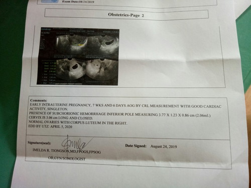 Subchorionic Hemorrhage ?