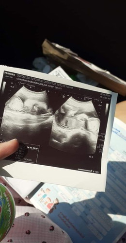 ตั้งครรภ์