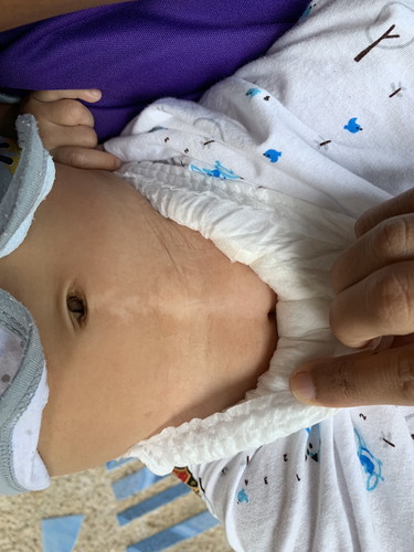 ลูกสาวเป็นอะไรไม่ทราบครับ