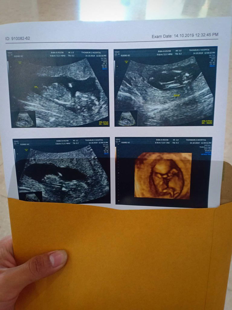 ซาวตอน12week