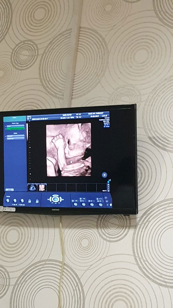 Perkembangan bayi 27 weeks