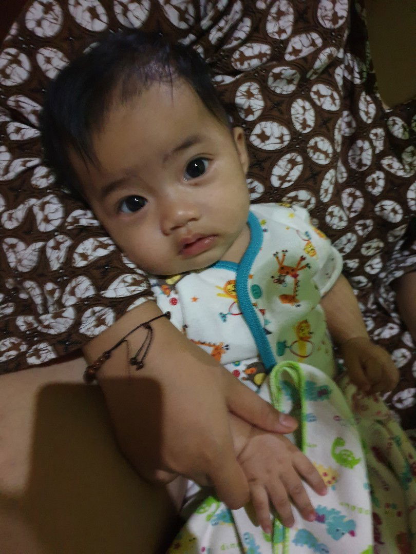 Bayi 4 bulan sariawan