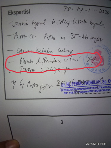 serius nanya