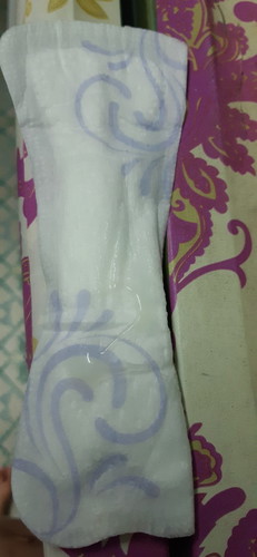 tanda atau keputihan