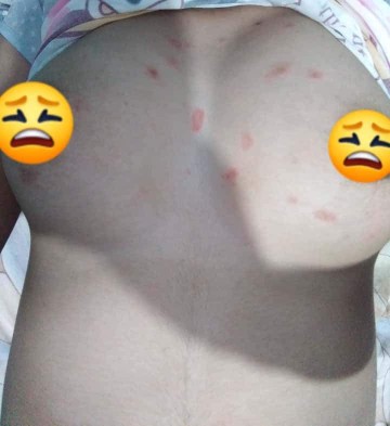 Any Treatment?
