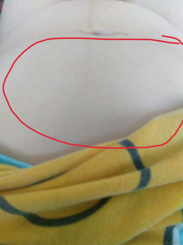 ท้อง5เดือน..อยากทราบตำแหน่งลูก