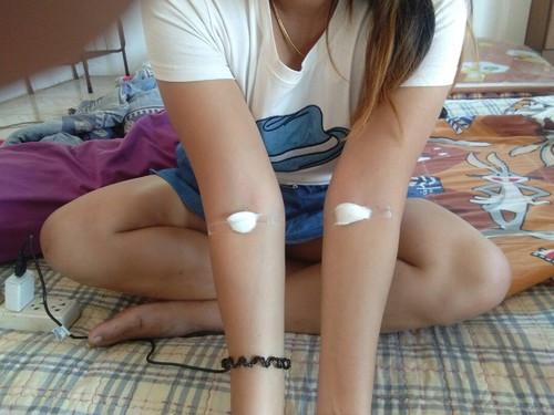 ตรวจเบาหวาน