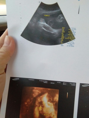 ท้อง7เดือน..ดีใจจังได้ลูกสาวค่ะ