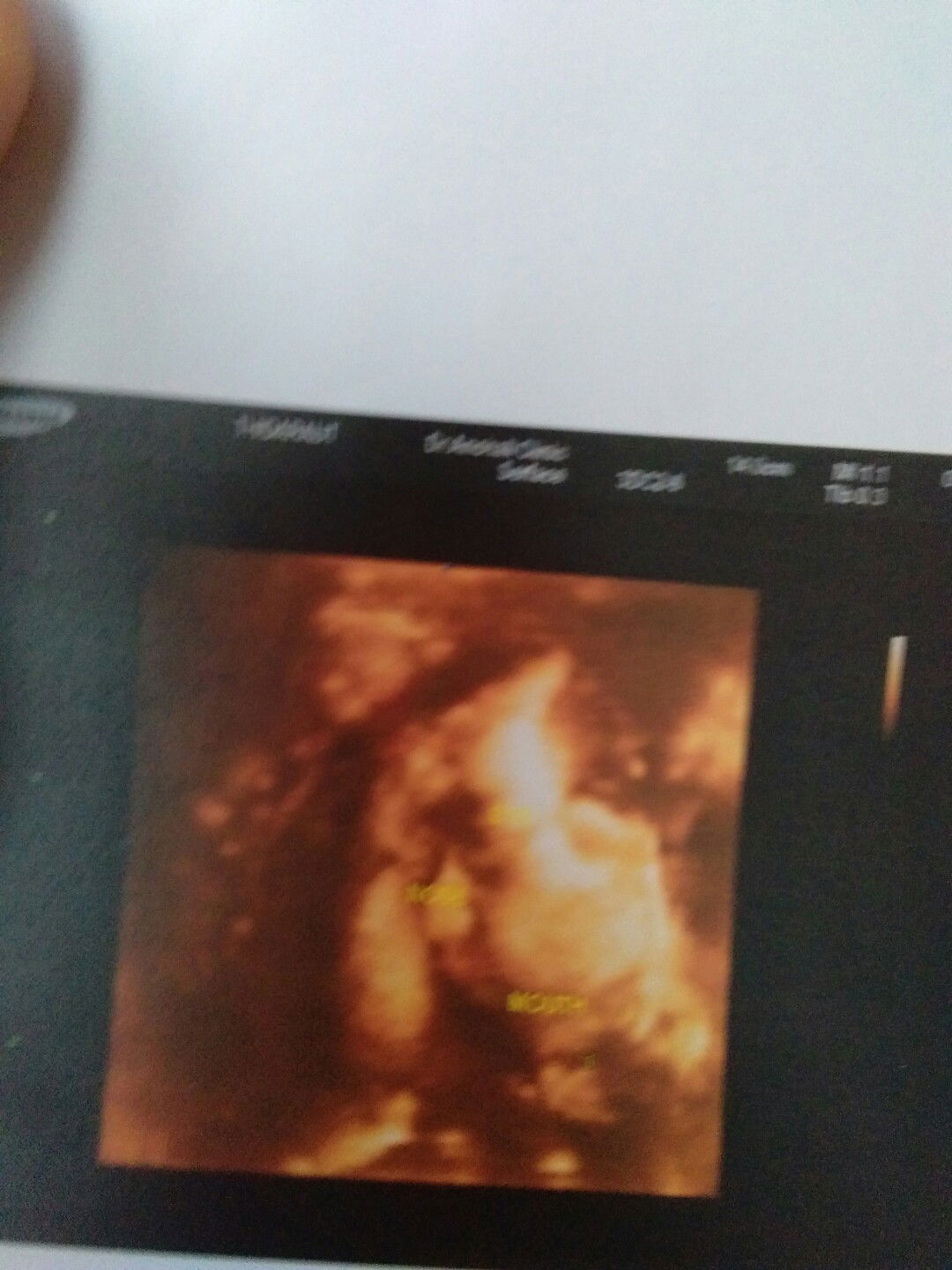 ธิดารัตน์ กฤษณะพันธุ์ profile icon