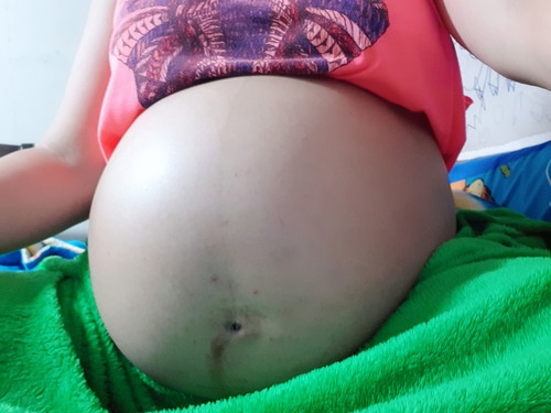 กำหนดคลอด 9 เม.ย.63