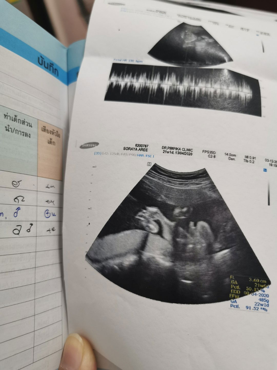 Little Boy ? กำหนดคลอดเมษาปีหน้าจร้า