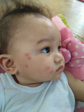 Baby