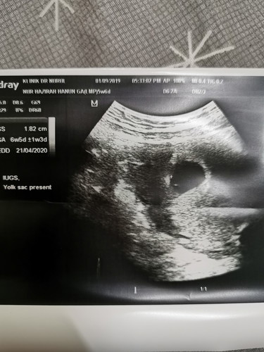 Our First Scan