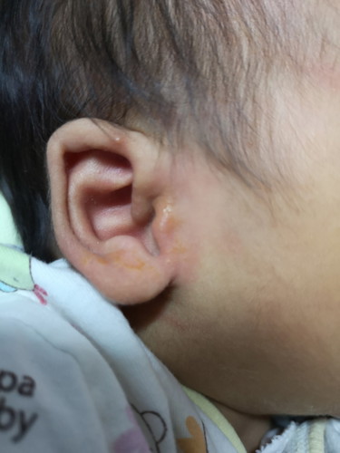 หูลูกมีสีเหลือง