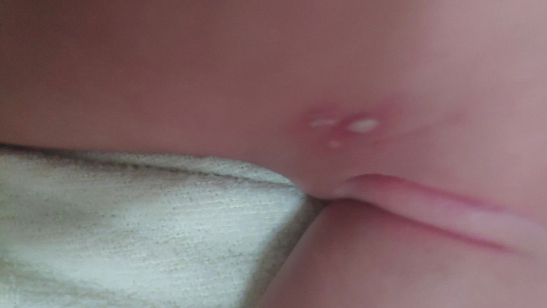 kulit bayi usia 2,5 bln