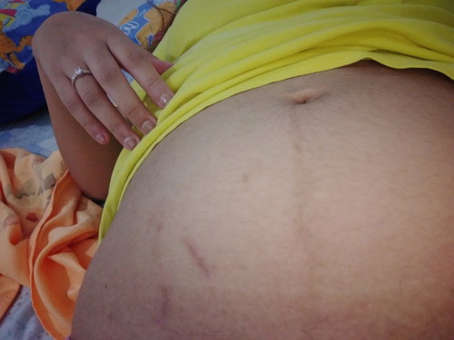 Baby bum