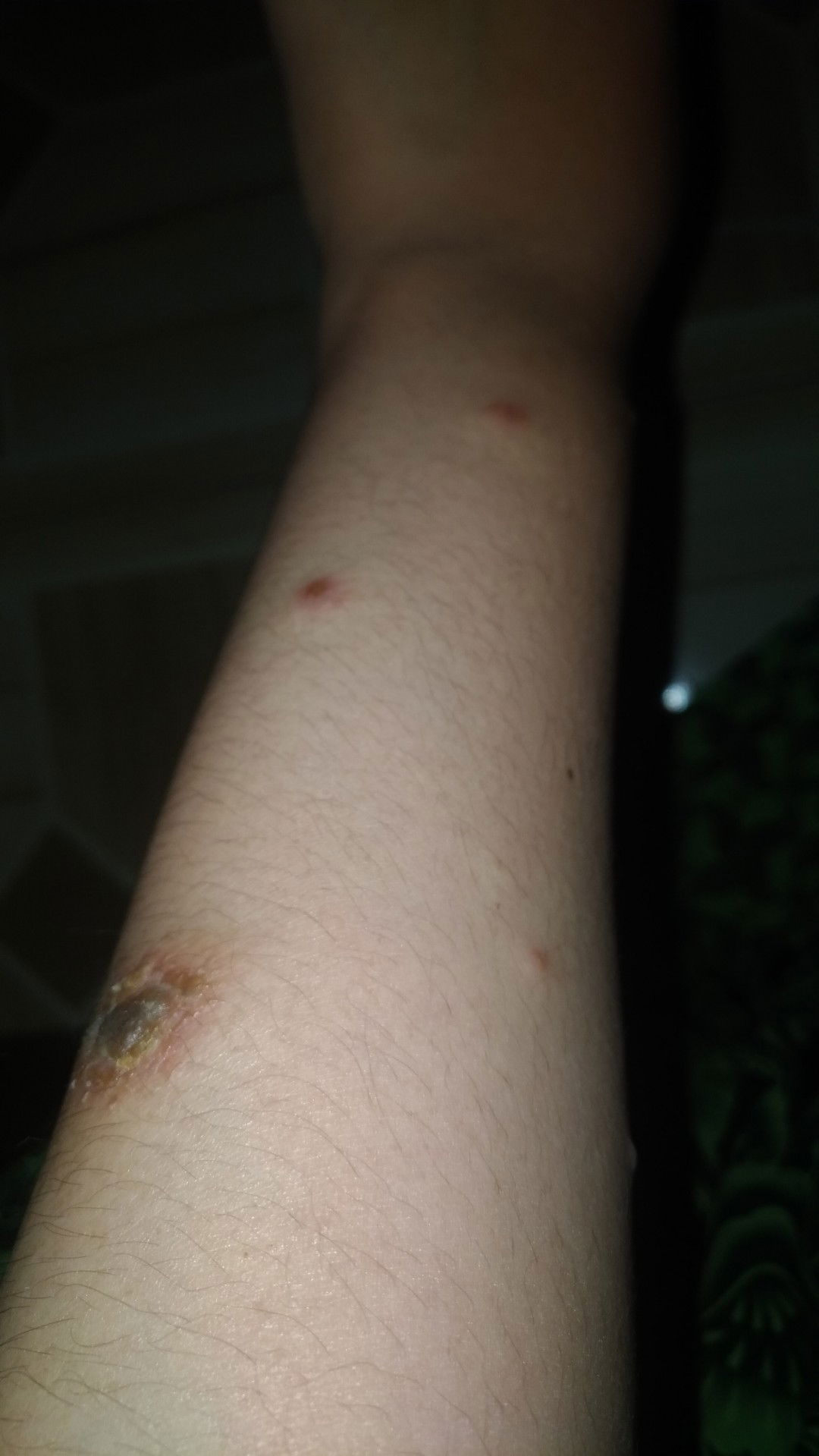 Gatal-gatal saat hamil