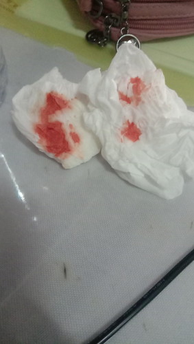 klwr darah dri dubur