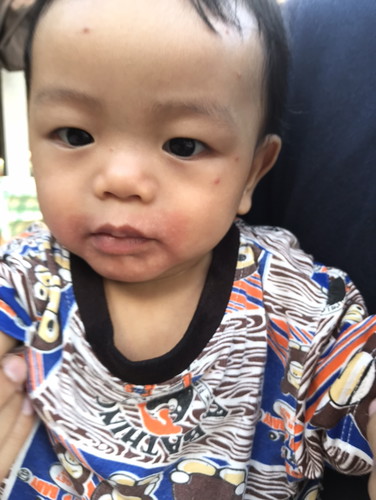 ลูกแพ้โยเกิต