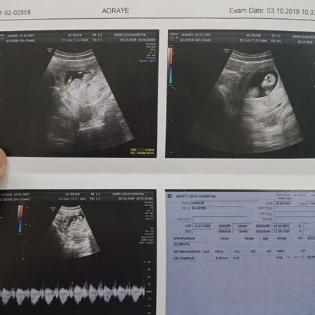 ฝากครรภ์ครั้งแรก