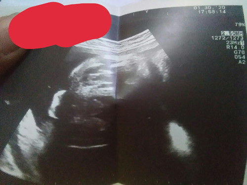 My 36 weeks ultrasound ?