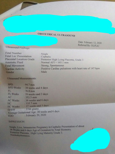 Nakakagulat ?