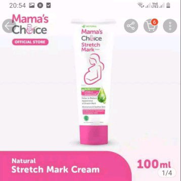 stretch mark