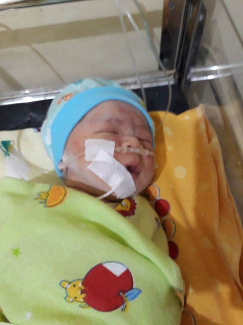 normal yg berujung sesar