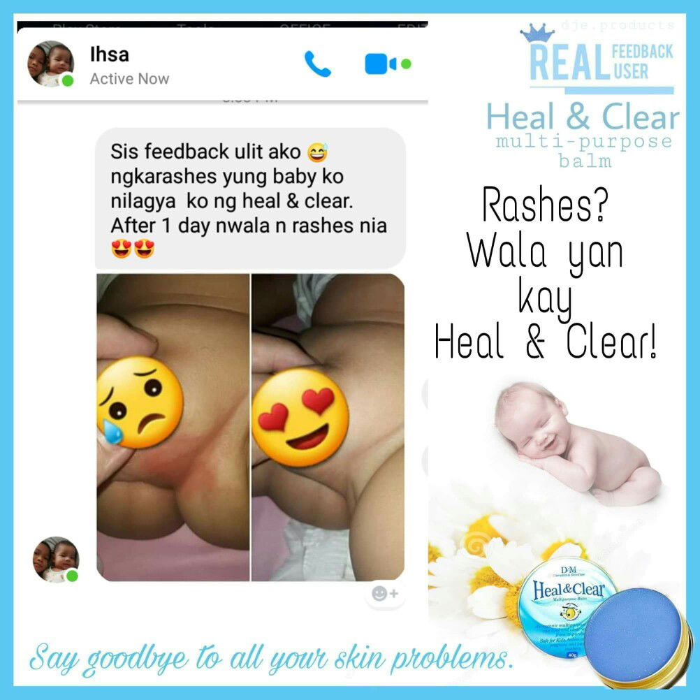 HEAL & CLEAR MULTIPURPOSE ORGANIC BALM