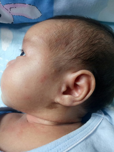 น้อง1เดือน5วันค่ะ