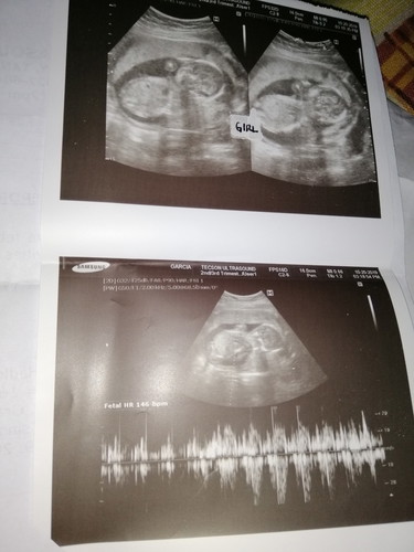Gender REVEAL