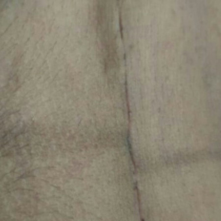 operasi sc