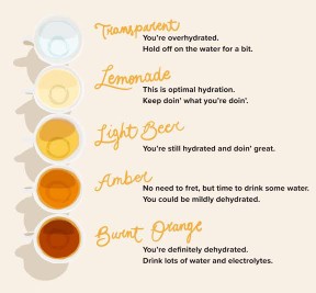 URINE SIGNS: