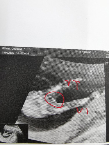 เพศอะไรเอ่ย