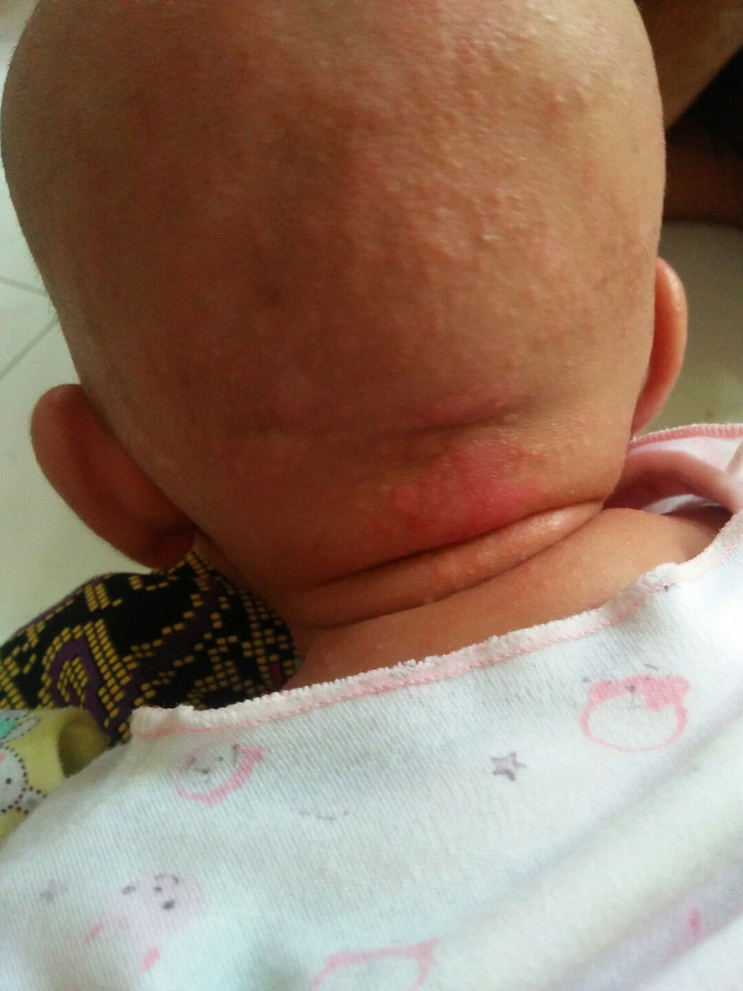 ini hal biasa apa nggak ya bun?