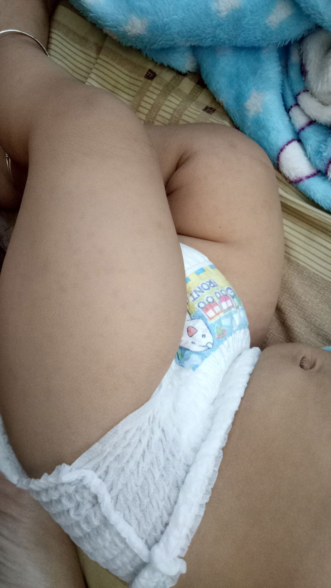 ขอความรู้เพิ่มเติมเกี่ยวกับส่าไข้