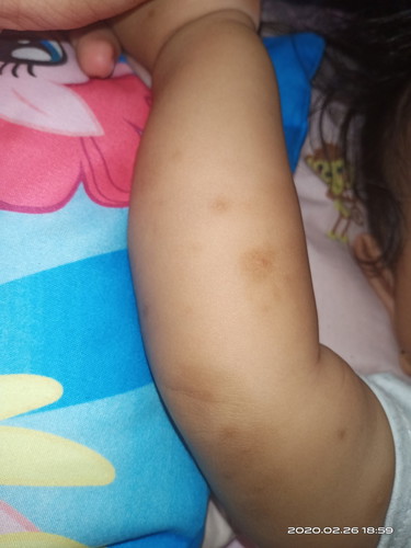 dark spot