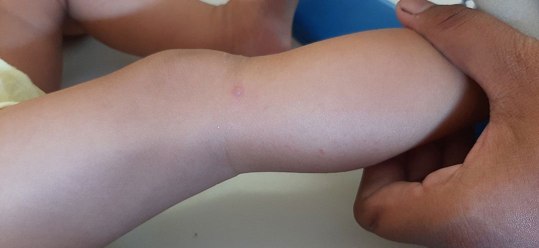 badan bayi bruntusan