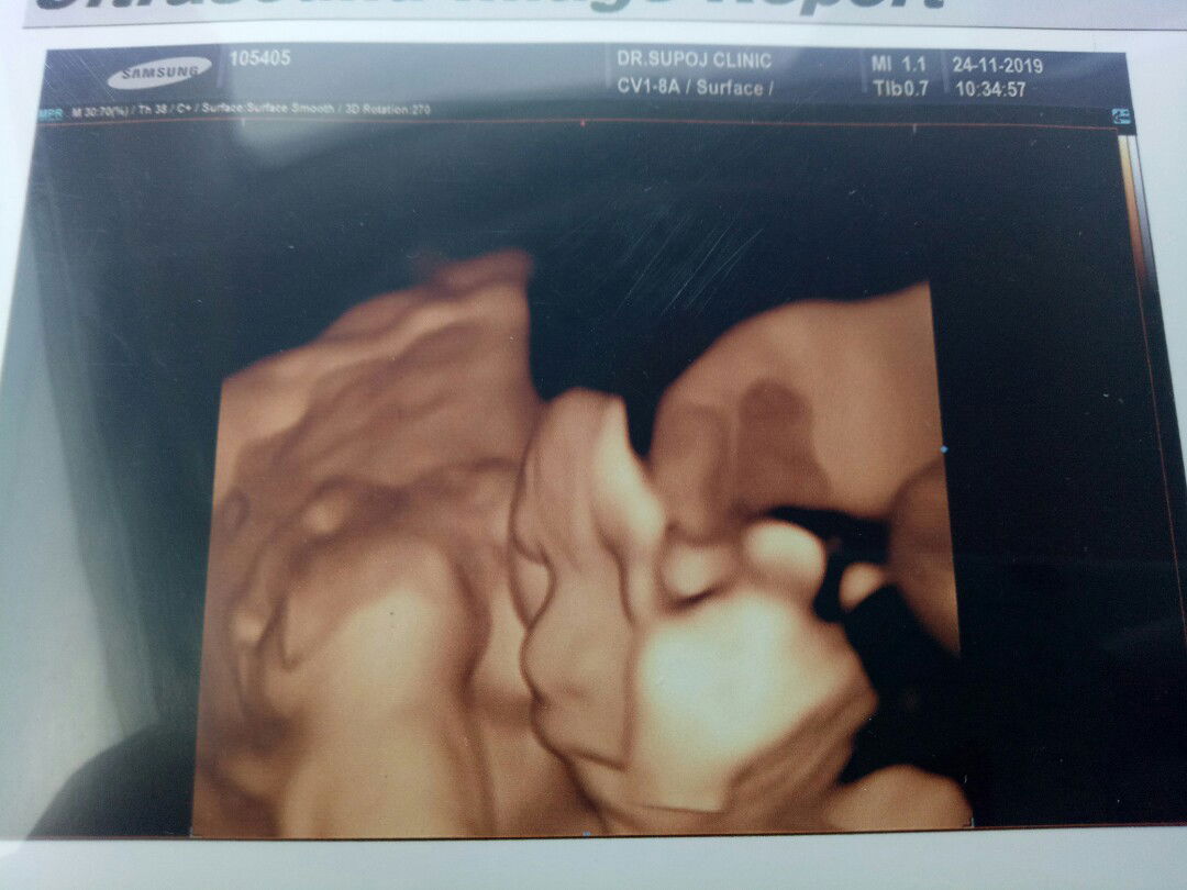 Pornsuda Sakam profile icon