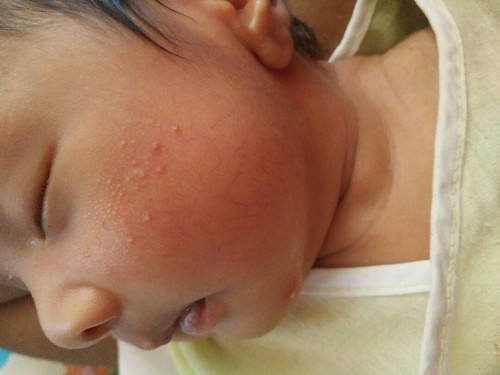 ลูกเป้นแบบนี้เพราะอะไรคะ