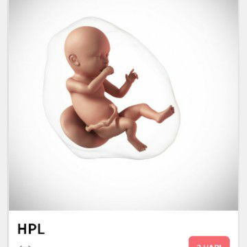 was was memdekati hpl