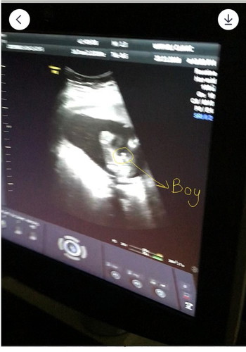 18w จู๋โผล่แล้วจ้า?