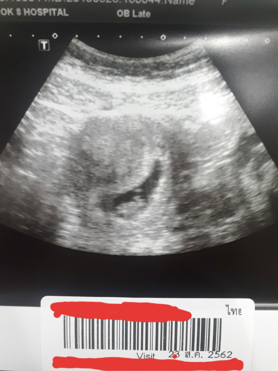 บอกเล่า