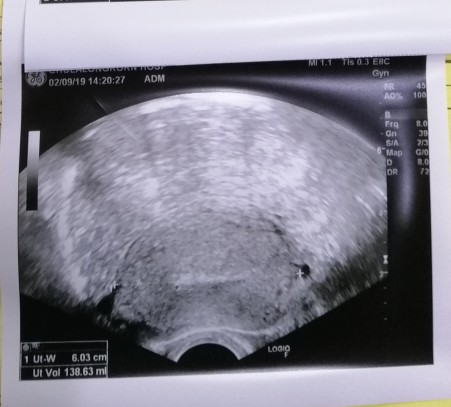 แท้ง 9 สัปดาห์