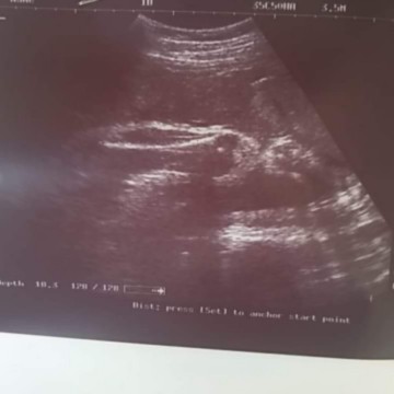 แม่บ้านใหนน้ำหนักลูกในท้องน้อยบ้างค้ะ