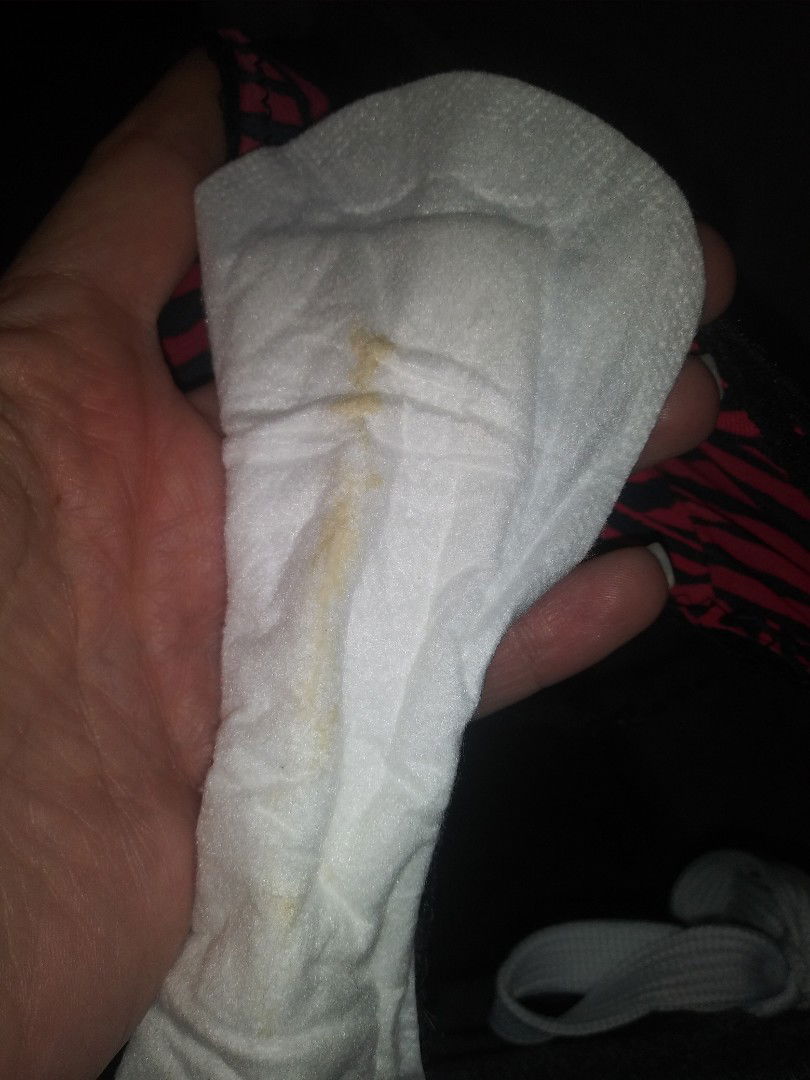 still having bleeding