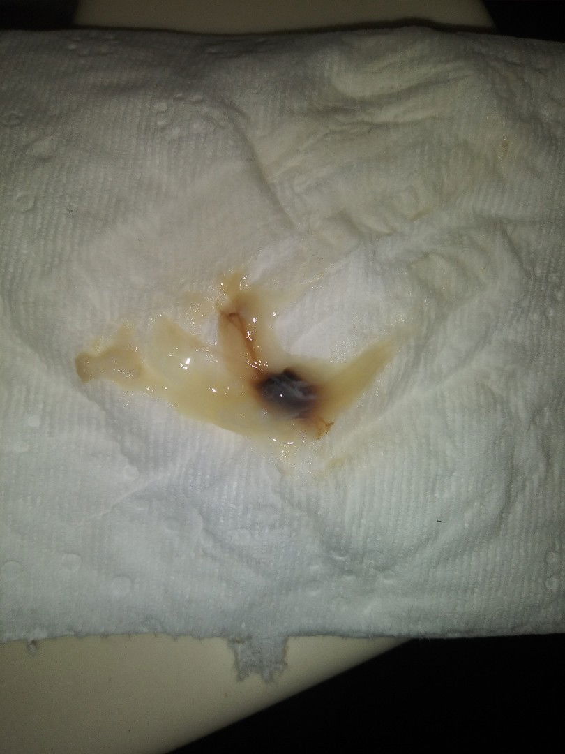 think i had my bloody show