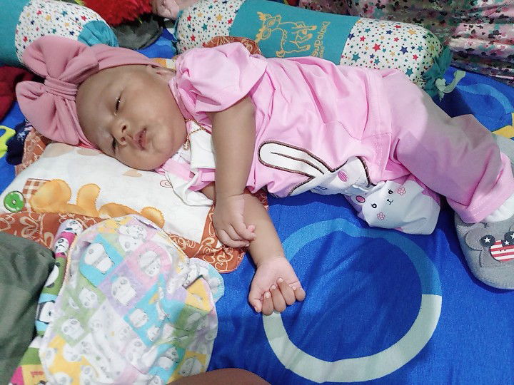 kulit bayi