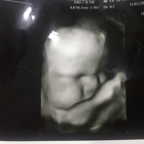 Amphai Seetongkam profile icon